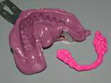 Perfect Smile clinical steps for Nobel Guide